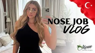 I flew to Turkey for a Nose Job... | Was it worth it?