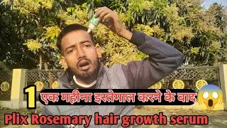 1 Month Used ll करने के बाद ll 😱Plix Rosemary Hair Growth serum