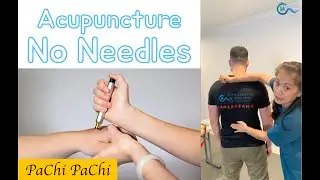 Acupuncture without Needles⚡️Pa-chi Piezo Electric Stimulator⚡️ #EileenHan #BalanceMethodAcupuncture