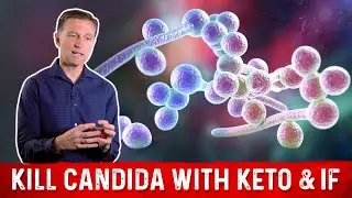 Kill Candida with Keto & Intermittent Fasting &ndash; Dr. Berg