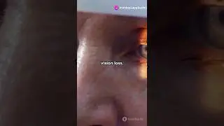 Melatonin and Eyes Aging!