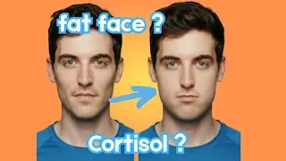 Face Puffiness vs  Real Fat Gain &mdash; Is Cortisol the Culprit?