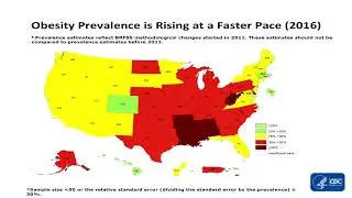 Elbert Huang - Geographic Disparities in Diabetes and Obesity and the Long Arc of Health Policy