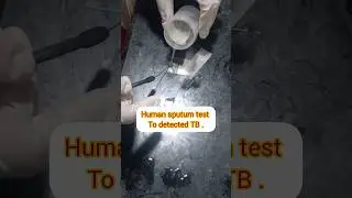 TB under microscope #shorts #viral #microscope #india