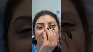 Before and after eyebrows transplanted  #shorts #youtubeshorts