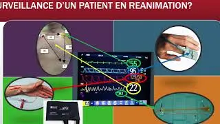 Une vidéo à destination des étudiants IDE à l'IFMS