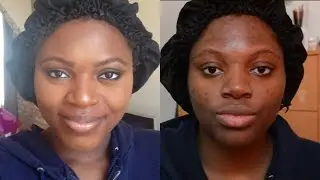 Foundation Routine ACNE marks & hyperpigmentation coverage - DARK SKIN