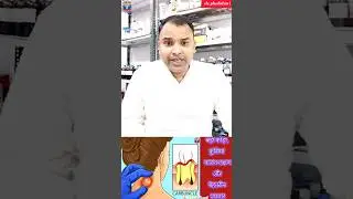 carbuncle and boils treatment |difference between furuncle and carbuncle