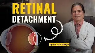 Retinal Detachment Treatment |Vision Protection | Dr. AK Singh | Eyes Specialist | Delhi