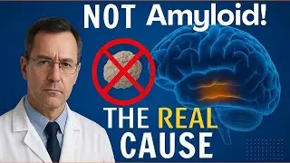 The REAL Cause of Alzheimer&rsquo;s Revealed &mdash; And It&rsquo;s NOT Amyloid Plaque Shocking Truth!