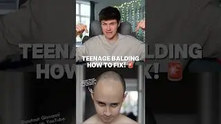 TEENAGE BALDING?! 🤯