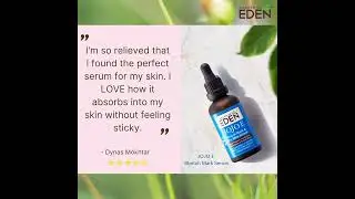 JOJO E Stretch Mark Cream & Serum Testimonial #GardenofEDEN