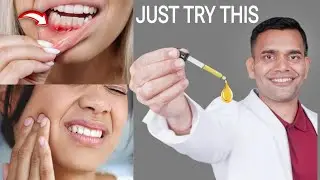 Just 1 Drop of this Oil to remove all your dental problems