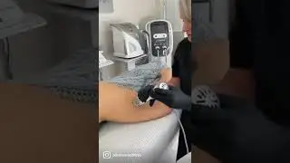 Zemits WaveRestore is an advanced percussion shock wave therapy device