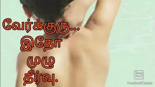 prickly heat solution |viyarkuru in tamil | jayam ideas | jayam pets | minpin puppy for sale