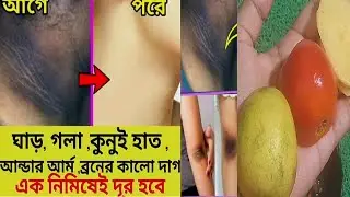 Body Tan,Dark Knee,Dark Elbow & Dark Neck Removal in Single Use/Get Rid of Dark Neck/Body whitening
