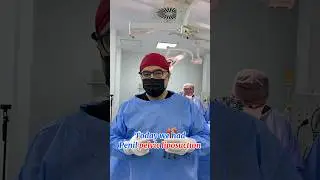 Penis lipofilling with pelvic liposuction ideal results 50 years old patient