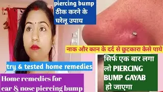Home remedies for ear & nose piercing bump|piercing bump ko जड़ से खत्म करने के घरेलू नुस्खे#nosebump