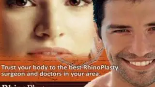 RhinoPlasty Guide #7