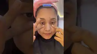Tired eyes? Dark circles stealing your glow? 😴 Eyecojic