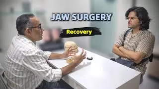 What Happens After Jaw Surgery? Recovery, Swelling & Healing Explained