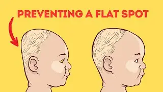 Best Way to AVOID a Flat Spot on Your Baby's Head