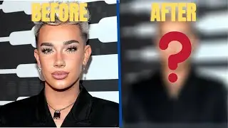 JAMES CHARLES PLASTIC SURGERY (GONE WRONG)