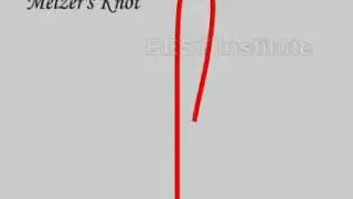 Melzer's knot - Laparoscopic Surgery Basics- AV Hospital