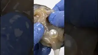 一颗珍珠的诞生：开鲍鱼惊现珍珠！ | Opening Abalone for Pearls