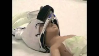 RESPIRATORY CARE: Bubble CPAP