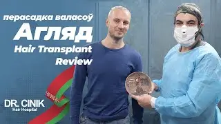 Dr. Cinik Клиника по трансплантации волос | Hair Transplant | Dr. Emrah Cinik