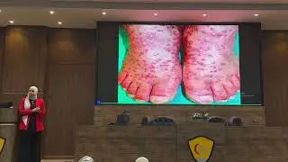 Primary & secondary skin lesions by Dr. Yosra Abdel Galeil MD IDPD
