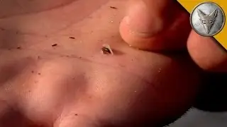 GROSS: Baby Leech Burrows Into Coyote's Hand!