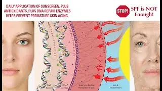 Category 4 Anti-oxidant Genes and Free Radical Damage to the Skin