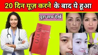 Glofara Skin Lightening Cream Honest Review,Glofara Skin Lightening Cream