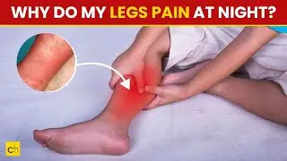 Why Do My Legs Ache At Night - Shocking Reasons Must Know