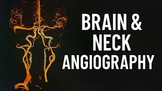How to Perform Brain & Neck Angiography 🧠🫁 | Full Demo 🎬