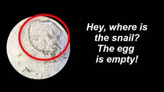 Life Cycle of a Pond Snail Egg