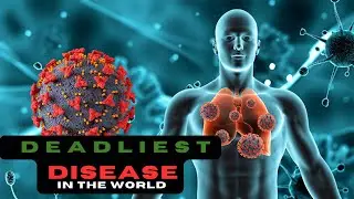 DEADLIEST DISEASES || Top 10 Deadliest Diseases in the World #disease #infection #deadliestdiseases