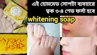 ফর্সা হওয়ার সাবান/হোমমেড সাবান/ malai kesar whitening soap review |পুরো শরীর ধবধবে ফর্সা করার সাবান