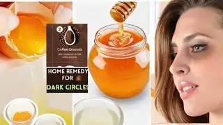 Homemade dark eye circles and eye bags remedy / Home remedies for removing dark circles.