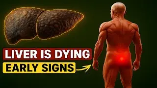 LIVER is DYING! 15 Strange Symptoms of Liver Damage You MUST Know