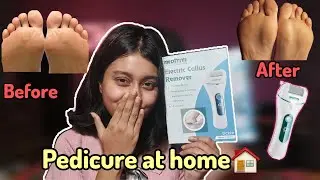 I am Totally Shook 🤯 MEDITIVE Electric Callus Remover Review+Demo|| Pedicure at home 🏡