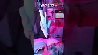 Fotona Laser Hair Removal: Benefits and Why It&rsquo;s the Best Choice | Clear Skin, Pune