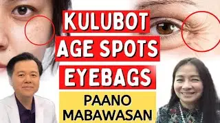 Kulubot, Age Spot, Eyebags Paano Mabawasan - By Doc Katty Go (Dermatologist) and Doc Willie Ong