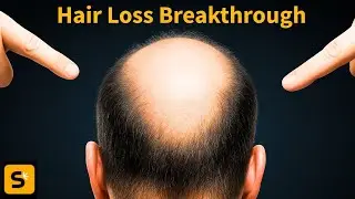 DNA sugar BREAKTHROUGH could treat hair loss