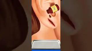 Kindly Treat the Cut | 3D Cartoon Surgery Animation YouTube Video |Game Play | Surgery Game #shorts