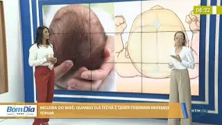 Fisioterapeuta explica quando a moleira de um bebê fecha e os cuidados necessários 14 01 2022