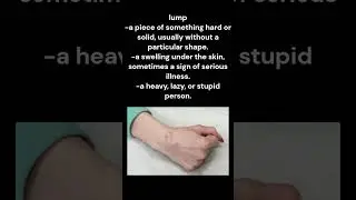 lump meaning and pronunciation-lump definition and pronunciation