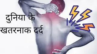 दुनिया के सबसे खतरनाक दर्द | most dangerous pain 😣 #shorts